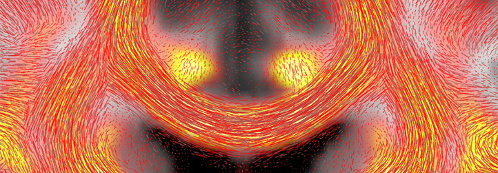 Neuroimaging in Freiburg