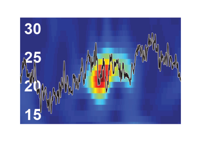 Brief Bursts, Big Insights Brief Bursts, Big Insights
