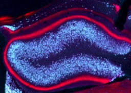 Tiefe Hirnstimulation verhindert im Mausmodell epileptische Anfälle Tiefe Hirnstimulation verhindert im Mausmodell epileptische Anfälle