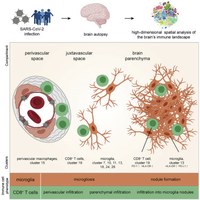 COVID-19 can cause severe inflammation in the brain 